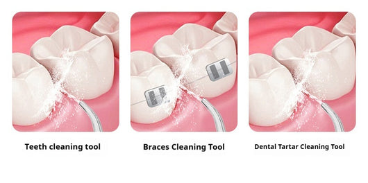 Pink portable electric oral irrigator with clear water tank and four nozzles, highlighting adjustable pressure and pulse mode. - Image 12