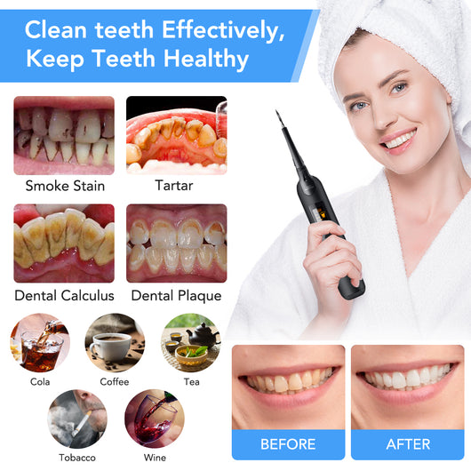 Limpiador Dental Ultrasónico Portátil para el Hogar - Image 12
