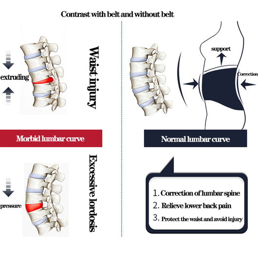 Cinturón de Descompresión Lumbar - Tracción para Hernias de Disco y Alivio del Dolor - Image 20
