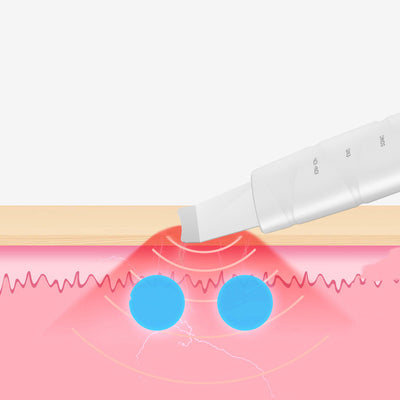 Limpiador Facial Ultrasónico Extractor de Puntos Negros - Image 4