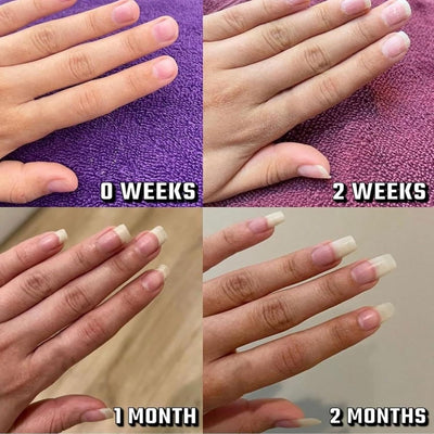 Aceite Fortalecedor para Uñas - Crecimiento y Hidratación Intensiva - Image 15