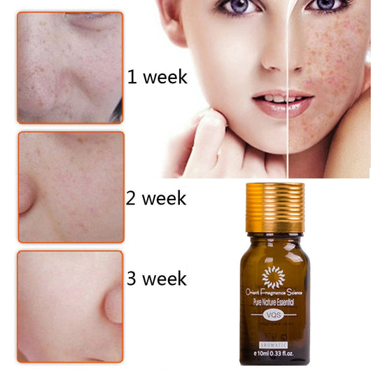 Esencia Facial Meridian - Tratamiento Natural para Acné, Estrías y Cicatrices - Image 6