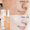 Crema Correctora de Pecas