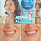 Limpiador Dental y Blanqueador de Dientes Profesional
