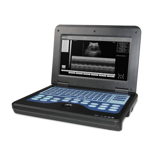 Ecógrafo Portátil Digital con Sonda Convexa 3.5 - Diagnóstico Profesional - Image 8