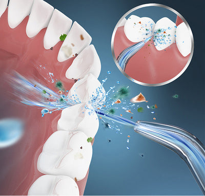 Limpiador Oral Portátil con Tecnología de Vibración Ultrasónica - Image 4