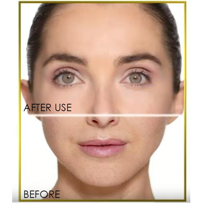 Depiladora Facial Flawless Glo - Removedor de Vello Indoloro - Image 3
