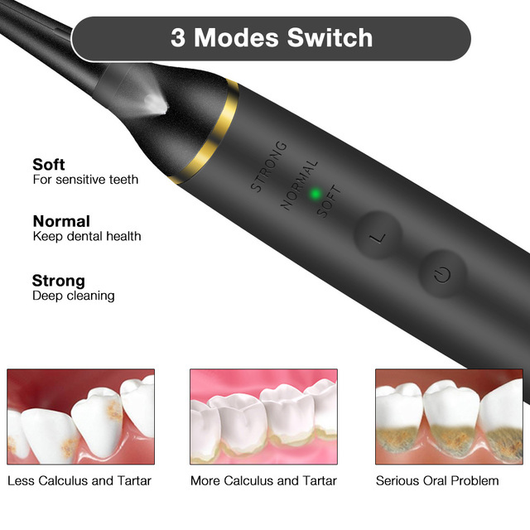 Limpiador Ultrasónico Dental Eléctrico Profesional - Image 8