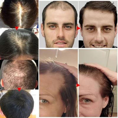Solución Nutritiva para el Cabello con Jengibre - Image 9