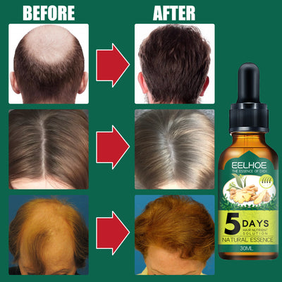 Aceite Esencial de Jengibre para el Cabello - Tratamiento Capilar Premium - Image 7