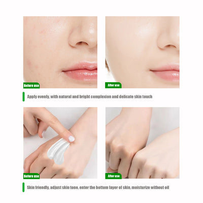 Crema Aclarador Facial Hidratante con Melanina - Image 9
