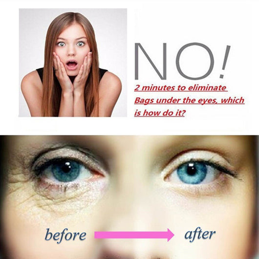 Crema Contorno de Ojos Potente Eliminadora de Ojeras - Image 8