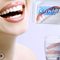 Carillas Dentales