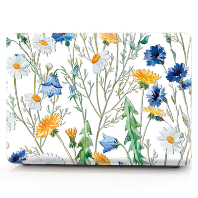 Funda Protectora Transparente para MacBook y Apple con Diseño Personalizado - Image 6