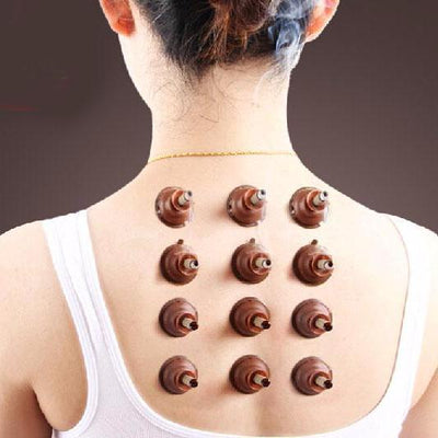 Set de 50 Tubos de Moxa Adhesivos para Moxibustión y Acupuntura
