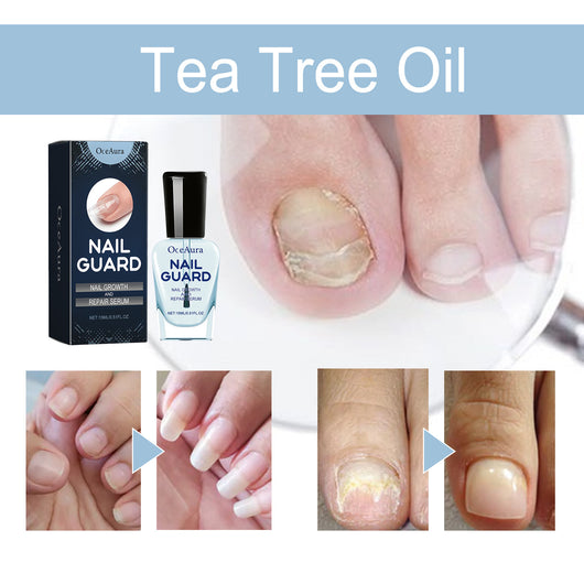 Tratamiento Nutritivo para Uñas de Manos y Pies - Reparación Intensiva y Brillo Natural - Image 15