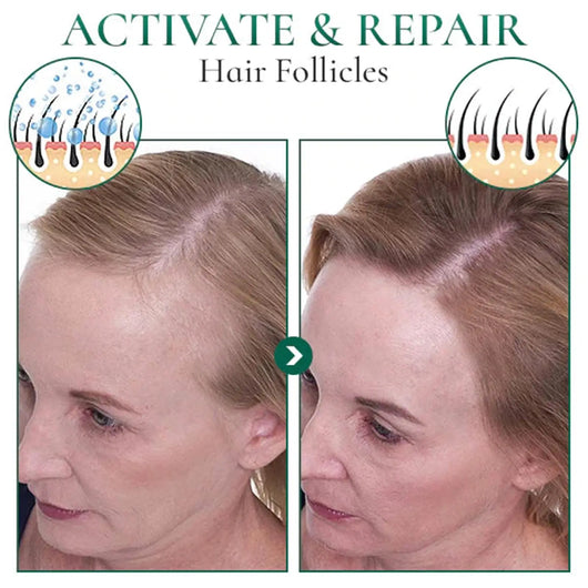 Aceite Esencial para Masaje Facial de Salón de Belleza - Image 17