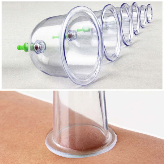 Kit de 12 Ventosas Terapéuticas Profesionales para Masaje y Bienestar - Image 9