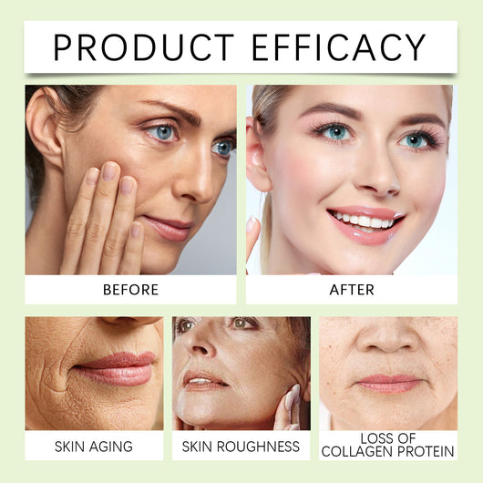 Crema Hidratante Facial - Nutrición Profunda y Protección de Humedad - Image 9
