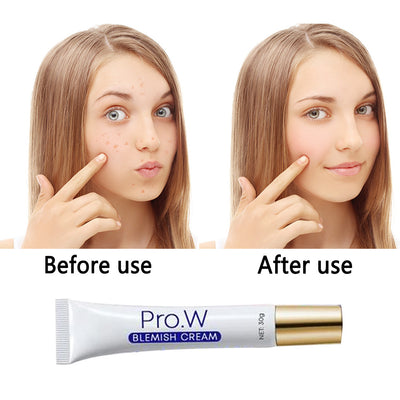 Crema Aclarador y Reductor de Pecas - Image 5