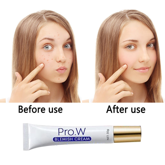 Crema Aclarador y Reductor de Pecas - Image 5
