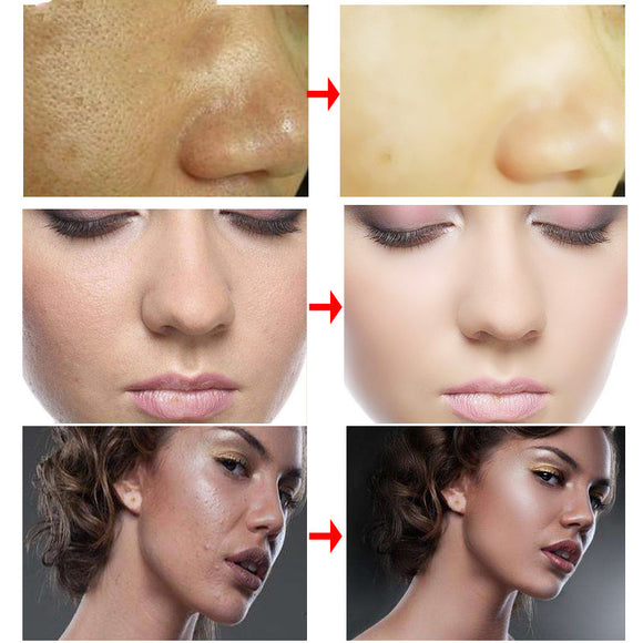 Crema RtopR - Tratamiento Facial Profesional
