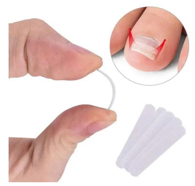 Parche Correctivo Ortodóntico para Uñas Encarnadas con Pinzas de Manicura - Image 17