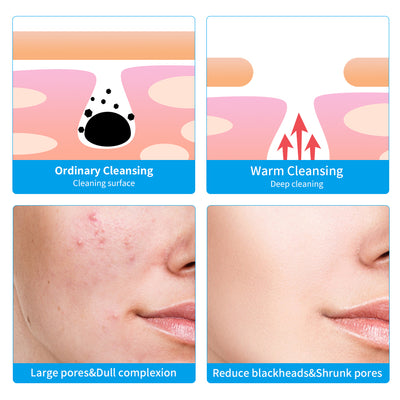 Limpiador Facial Eléctrico de Silicona - Image 24