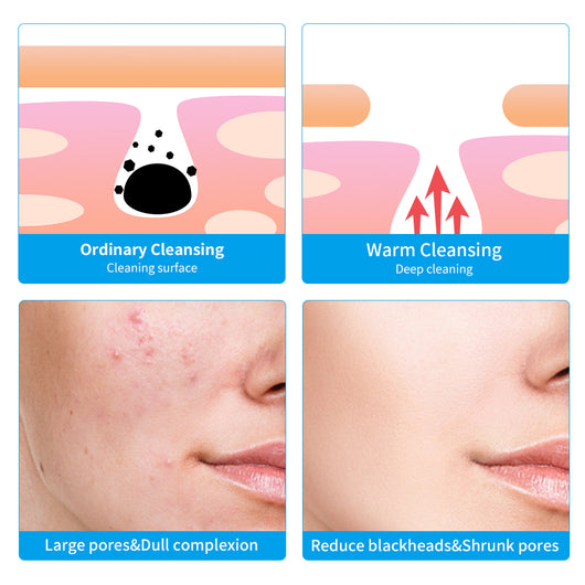 Limpiador Facial Eléctrico de Silicona - Image 24