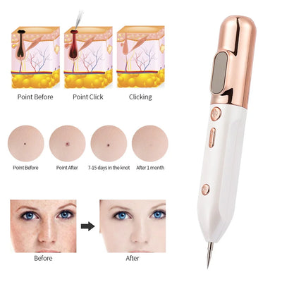 Dispositivo Facial de Luz Azul Antiacné - Image 14