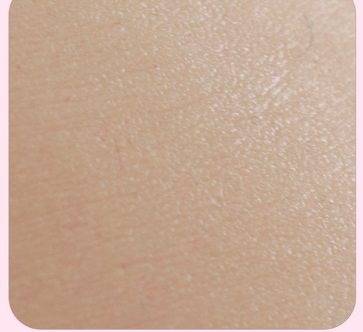 Prótesis de Seno Artificial de Silicona Tamaño Grande para Hombre - Image 12