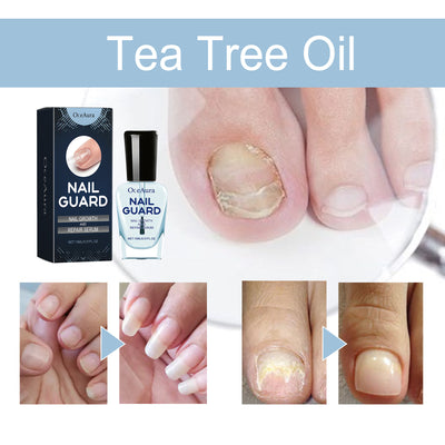 Tratamiento Nutritivo para Uñas de Manos y Pies - Reparación Intensiva y Brillo Natural - Image 3