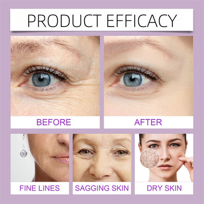 Suero Rejuvenecedor de Colágeno y Retinol - Antiarrugas Potente - Image 17