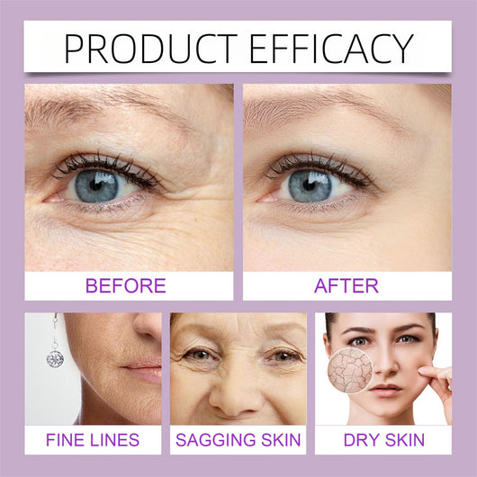 Suero Rejuvenecedor de Colágeno y Retinol - Antiarrugas Potente - Image 17
