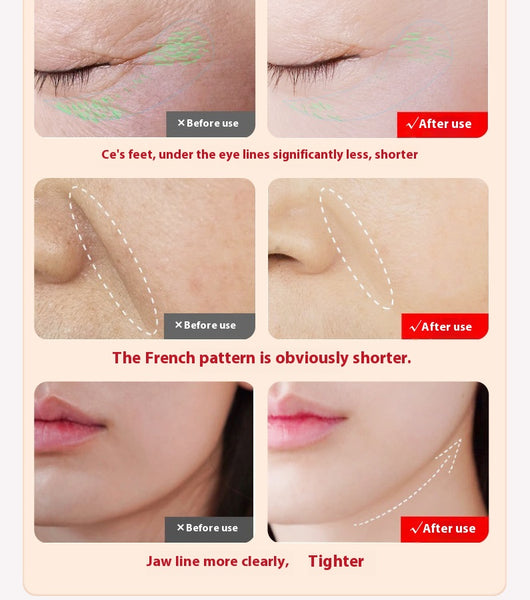 Dispositivo de Lifting Facial con Microcorriente - Rejuvenecimiento y Tonificación - Image 15