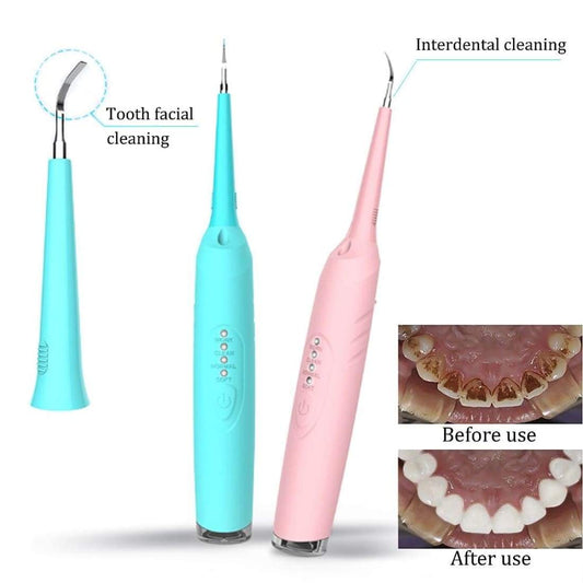 Removedor de Sarro Dental Profesional - Image 2