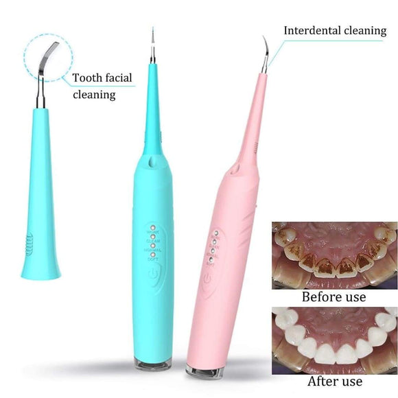 Removedor de Sarro Dental Profesional