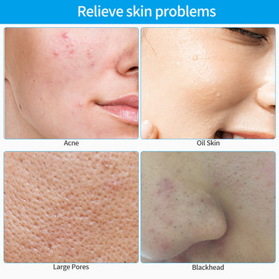 Limpiador Facial Eléctrico de Silicona - Image 18
