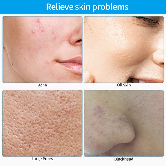 Limpiador Facial Eléctrico de Silicona - Image 18
