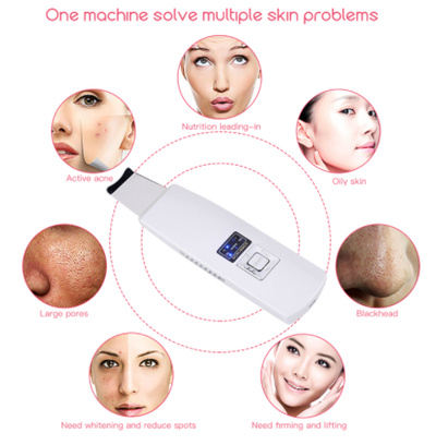 Limpiador Ultrasónico Facial con Masaje Vibratorio - Eliminador de Puntos Negros y Acné - Image 2