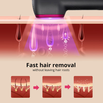 Black and pink IPL laser hair removal device kit with power adapter, safety glasses, razor, and manual. - Image 5