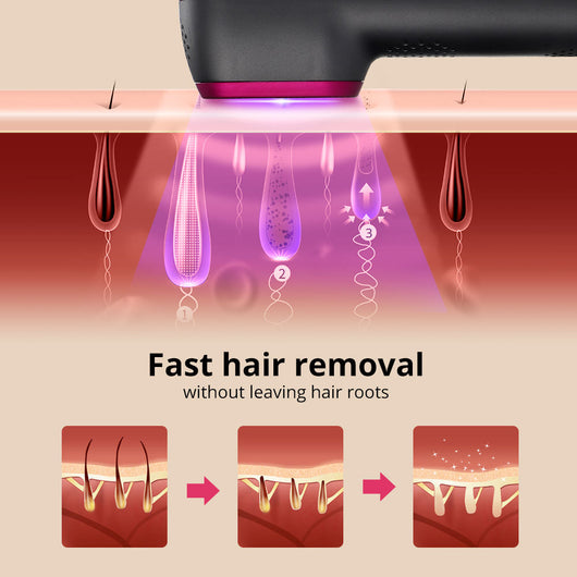 Black and pink IPL laser hair removal device kit with power adapter, safety glasses, razor, and manual. - Image 5