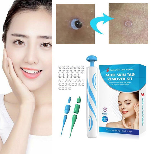 Removedor de Lunares y Verrugas Indoloro - Herramienta de Belleza Facial - Image 6
