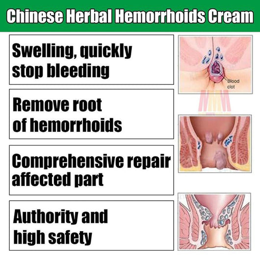 Crema Dual Dermatológica - Acné y Hemorroides