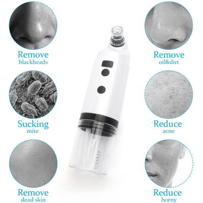 Limpiador Facial Ultrasónico Extractor de Puntos Negros y Acné - Image 9