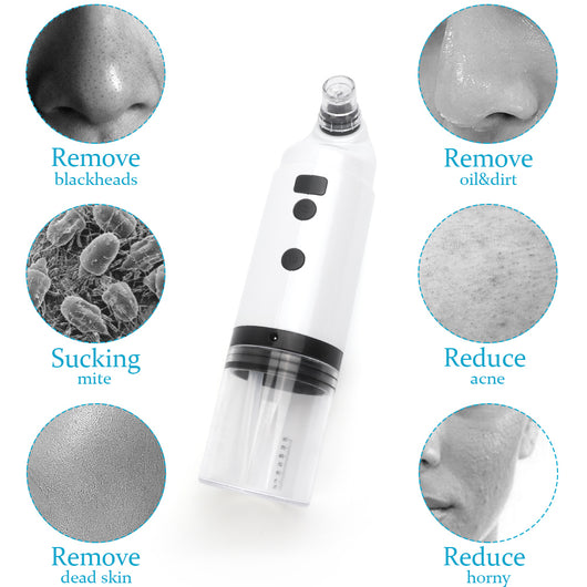 Limpiador Facial Ultrasónico Extractor de Puntos Negros y Acné - Image 9