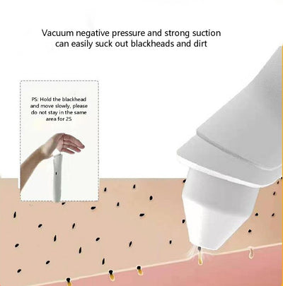 Extractor de Puntos Negros con Visualización LED y Succión Eléctrica - Image 9