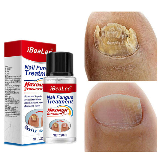 Solución Líquida Bacteriostática Espesante para Onicomicosis - Image 3