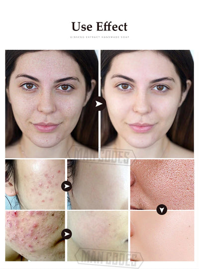 Barra Limpiadora Blanqueadora Control de Grasa con Ginseng - Image 14