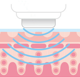 Masajeador Facial con Tecnología de Iones - Image 3
